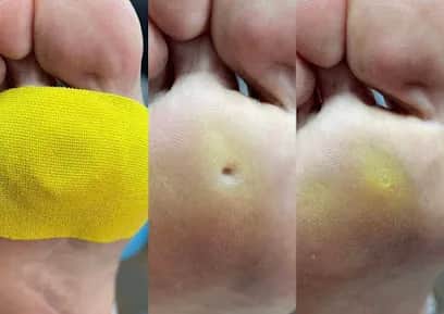 Sofia Mendes- Sports Medical Pedicure Center Blush Estetica, Lisbonne